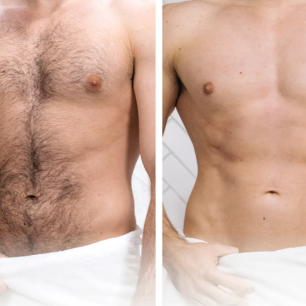 #1 Rasoio DermaSafe Testa,Viso,Corpo e Sotto Girovita