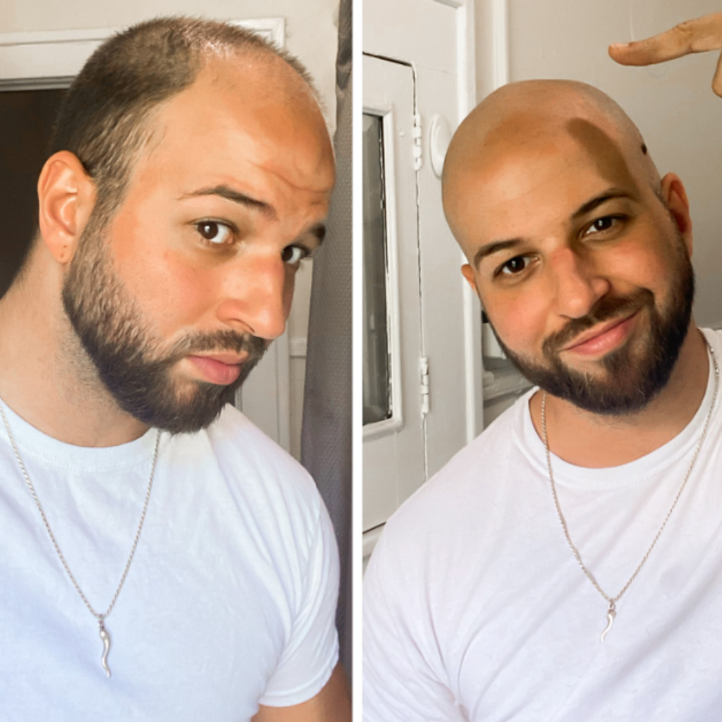 #1 Rasoio DermaSafe Per Calvi Kit Lainor™